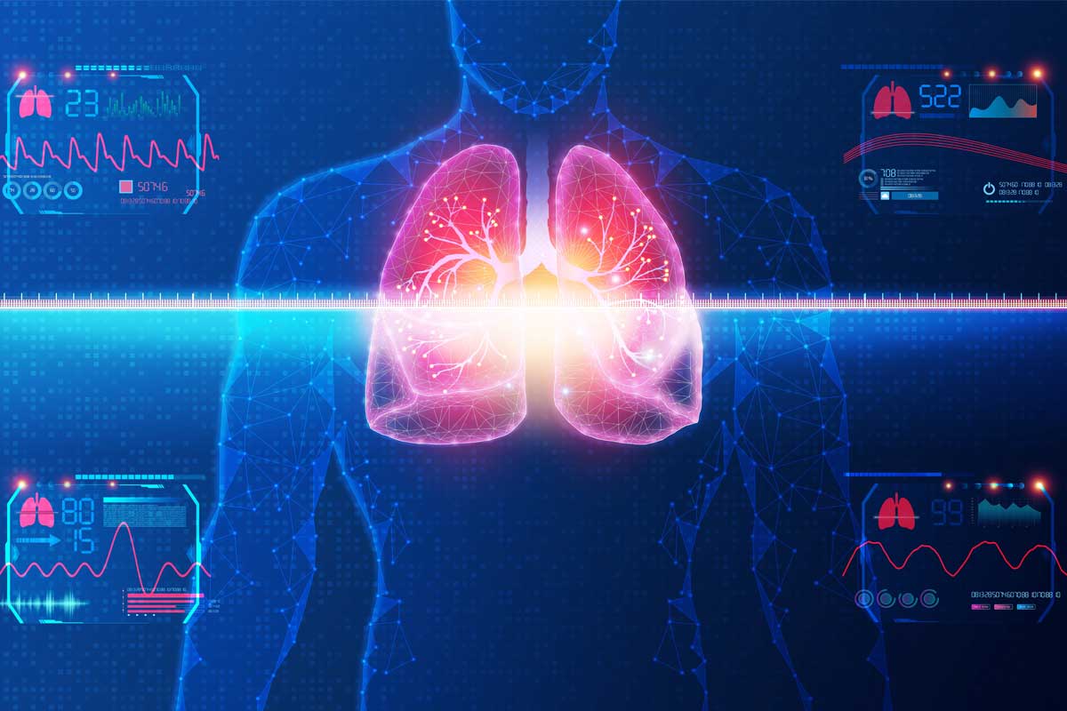 Breathing New Life into Pulmonary Medicine Lung Health Analytics